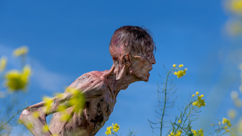 Skinally infected man 28 years later