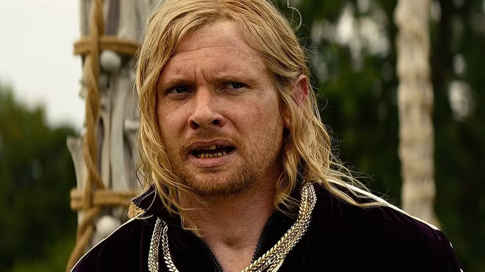 28 Years Later: The Bone Temple's Grossest Scene Will Test The Stomachs Of Even The Most Hardened Horror Fans