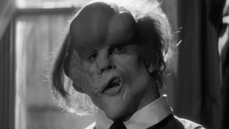 John Merrick (John Hurt) looking forward in The Elephant Man