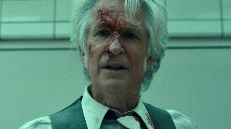 Dr. Brenner looking surprised with blood coming down his face from multiple wounds in Stranger Things