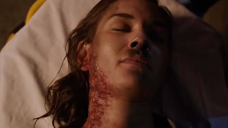 Teri Reeves as Hallie Thomas, burned an on a stretcher in Chicago Fire