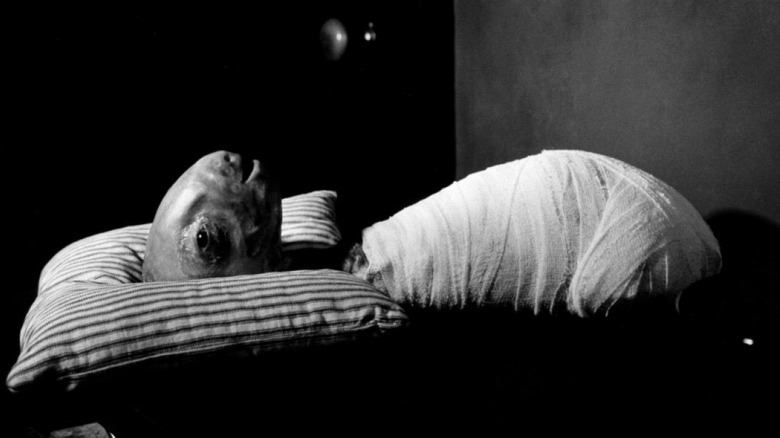 An inhuman creature lies bandaged in David Lynch's Eraserhead