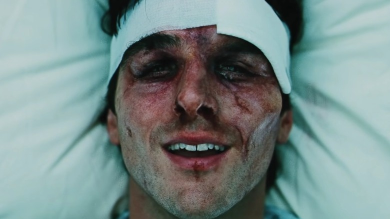 Nate beat up bandaged