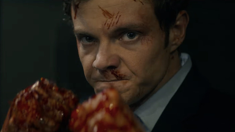 Nathan shows creativity with his punch in Novocaine