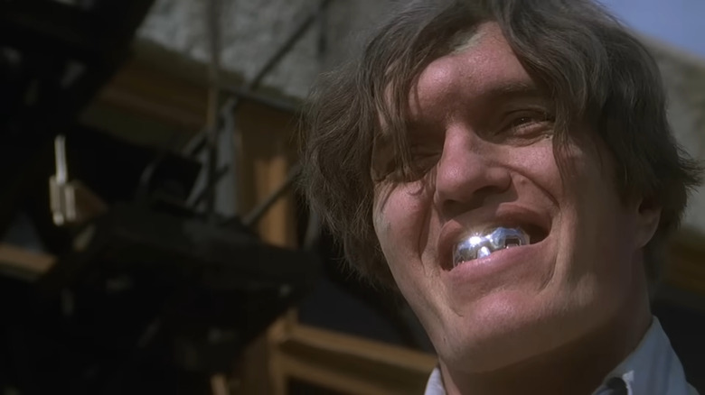 How Did Jaws Get His Metal Teeth