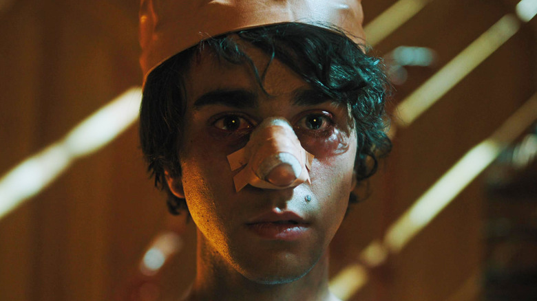 Alex Wolff's Peter is seen with a bandage on his nose in Hereditary