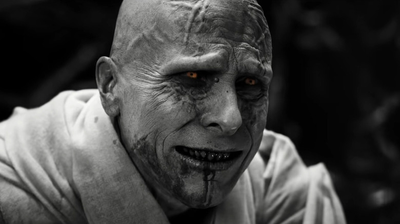 Christian Bale in immense pain