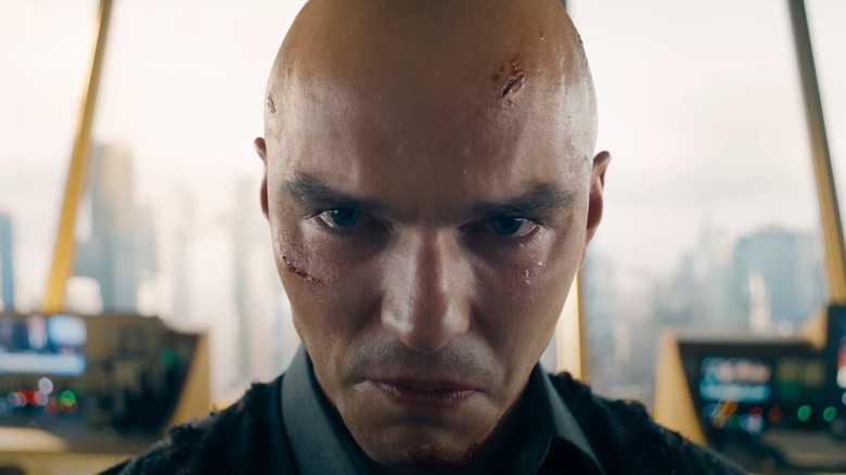 Close-up of Lex Luthor with cuts and bruises on his face grimacing in the LuthorCorp building in Superman