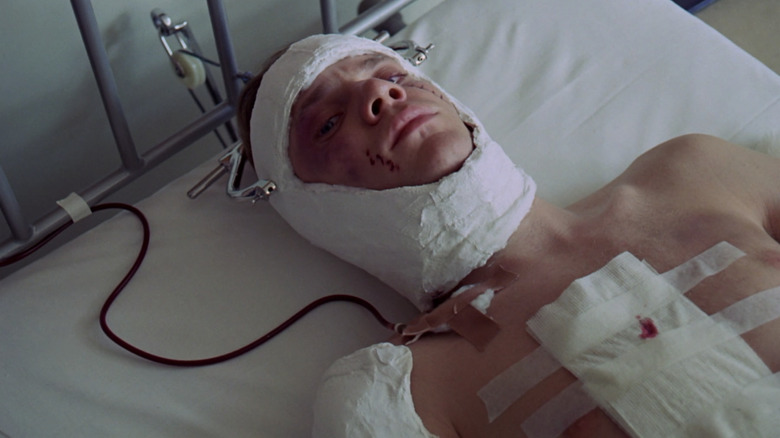 A Clockwork Orange Alex Therapy