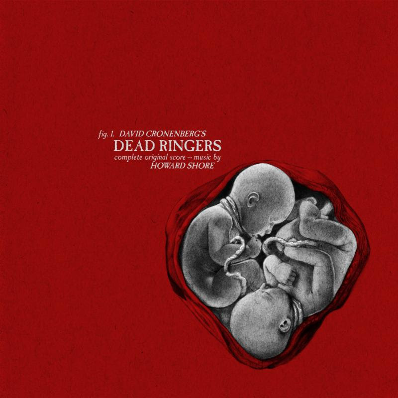 Dead Ringers Vinyl
