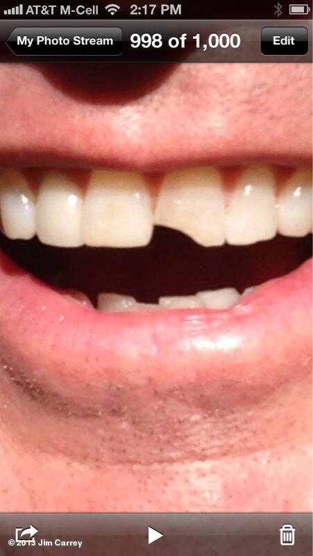 Jim Carrey teeth