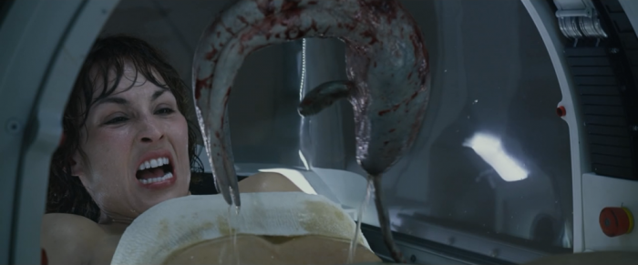 prometheus surgery scene